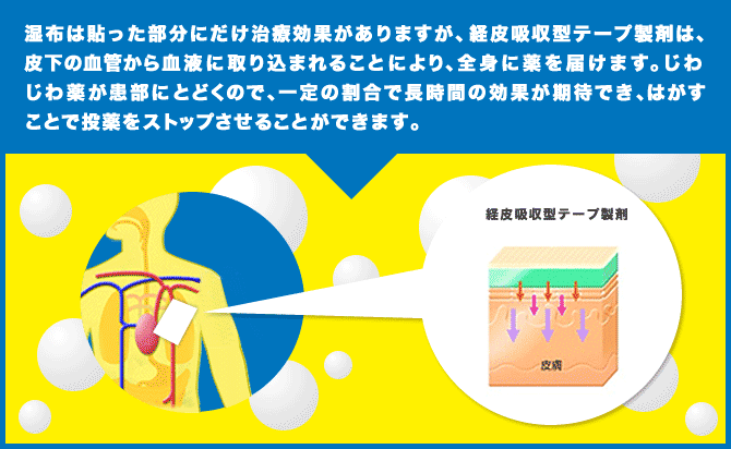 湿布は貼った部分にだけ治療効果がありますが、経皮吸収型テープ製剤は、皮下の血管から血液に取り込まれることにより、全身に薬を届けます。じわじわ薬が患部にとどくので、一定の割合で長時間の効果が期待でき、はがすことで投薬をストップさせることができます。