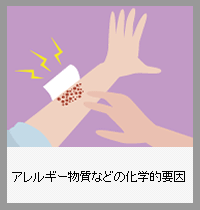 アレルギー物質などの化学的要因