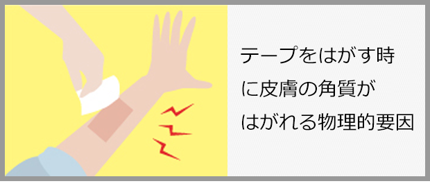 テープをはがす時に皮膚の角質がはがれる物理的要因