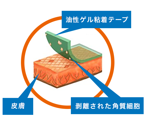 柔らかいゲル状の粘着剤なので、テープをはがすに角質をほとんどはがしません。