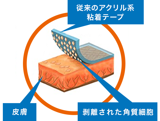 柔らかいゲル状の粘着剤なので、テープをはがすに角質をほとんどはがしません。